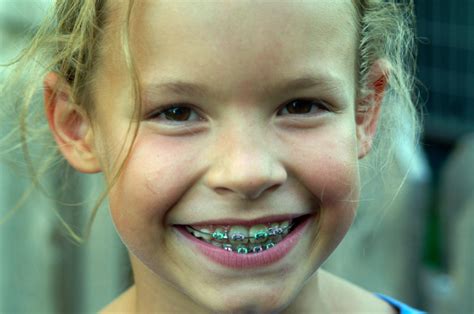Young Girl With Braces Peralta Orthodontics
