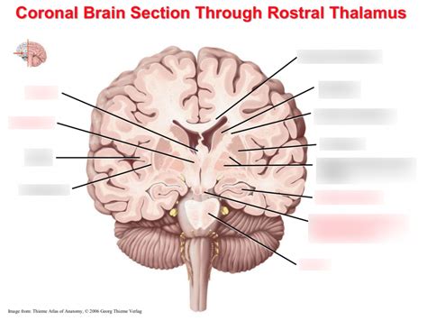 Coronal Brain Section Through Rostral Thalamus Diagram Quizlet