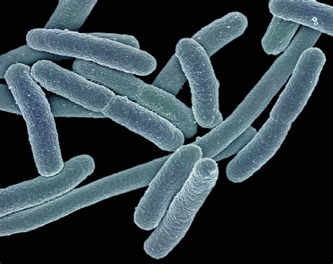 Escherichia Coli Bacteria Photograph By Science Stock Photography Science Photo Library Pixels