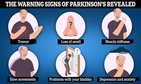 Six Warning Signs Of Parkinson S Revealed After Neil Diamond Opens Up About Living With The