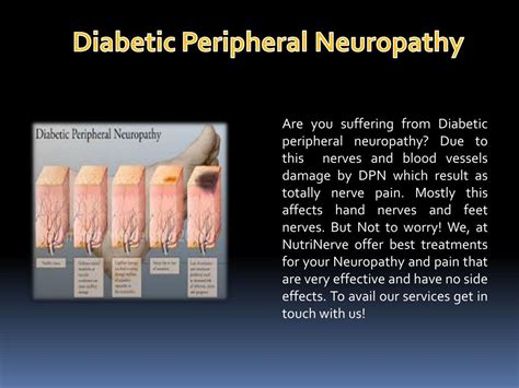 Ppt Understand What Is Diabetic Peripheral Neuropathy Powerpoint