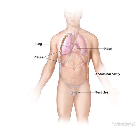 Stretching out the muscles of the chest and the rib. Malignant Mesothelioma—Patient Version - National Cancer ...