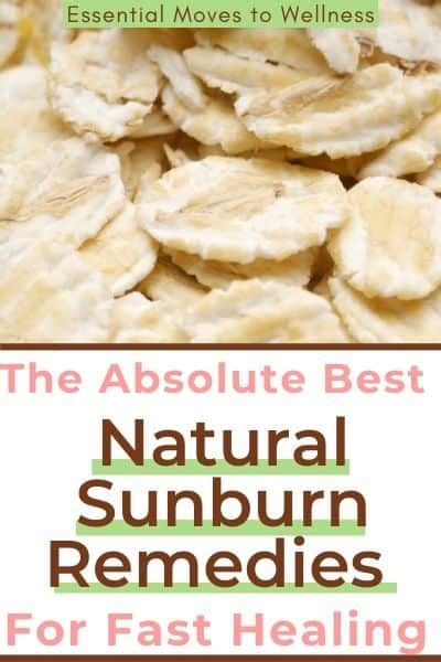 Natural Sunburn Remedies That Are Effective Easy And Work Fast