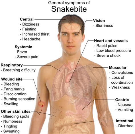 How To Treat A Snake Bite Without Medical Help Snake Poin