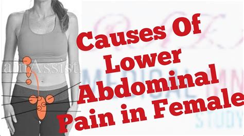 Causes Of Lower Abdominal Pain In Female Youtube