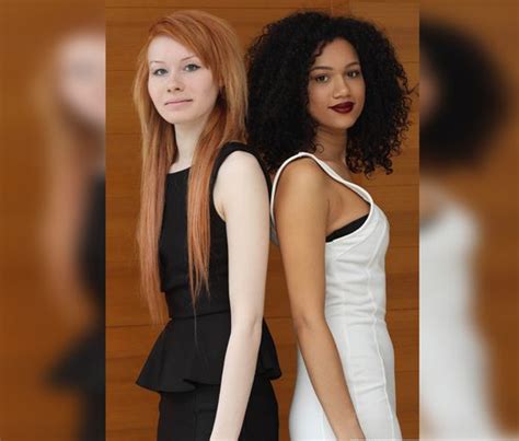 20 years after their birth captivated the world the aylmer twins are all grown up