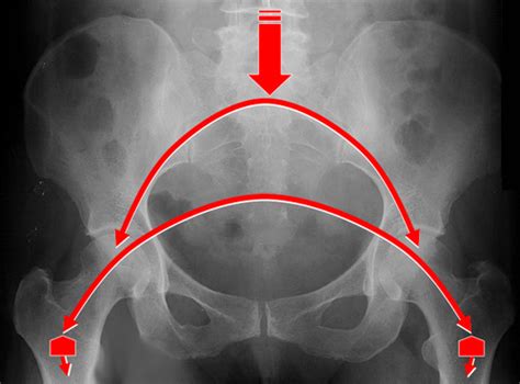 Applied Anatomy Of The Pelvis Sex Determination Flashcards Quizlet