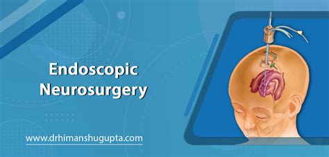 Endoscopic Neurosurgery In Jaipur By Dr Himanshu Gupta