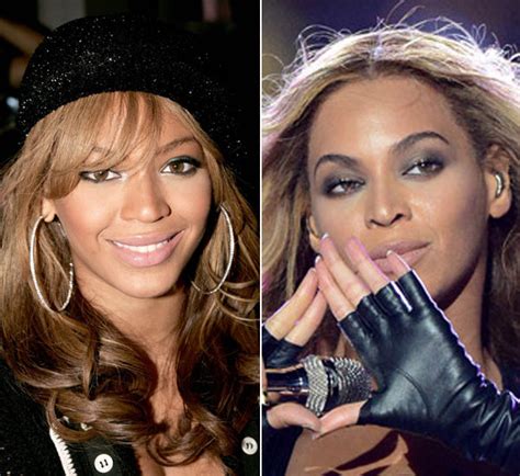 Beyonce Nose Job Before And After 2022