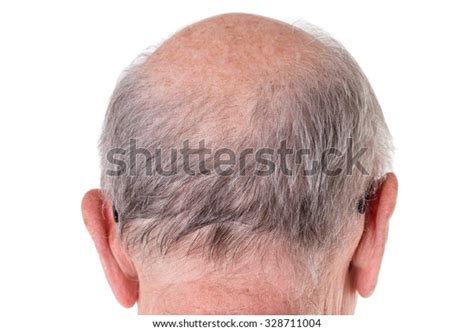 Back Bald Head Old Man Back Stock Photo 328711004 Shutterstock