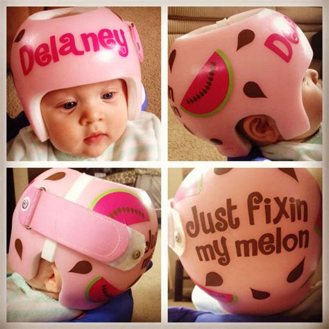 Helmet For Plagiocephaly Baby Helmet Kids Helmets Baby Pictures