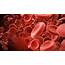 Blood Clot Awareness Could Save Your Life  Health Insight