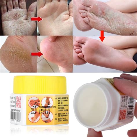 1pc Foot Care Cracked Heel Cream For Rough Dry Cracked Chapped Feet Remove Dead Skin Soften Foot