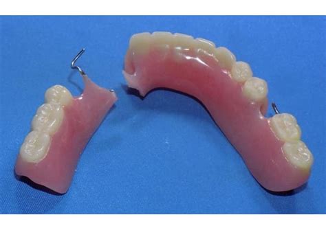 Partial Denture And Dental Bridge Repair Denture Repair Lab