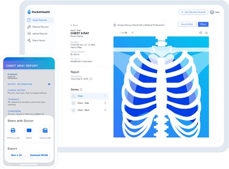 Pockethealth Securely Access Your Medical Imaging And Records