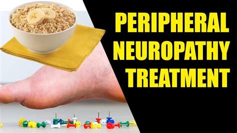 Peripheral Neuropathy Treatment Youtube