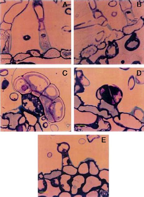 Basil is used for stomach spasms, loss of appetite, intestinal gas, kidney conditions, fluid retention, head colds, warts, and worm infections. Light micrographs of glandular trichomes of leaves of ...