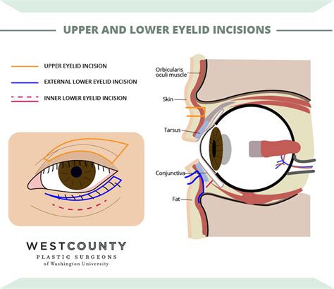 Eyelid Surgery St Louis West County Plastic Surgery