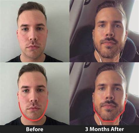 Get jawfit pro, the simplest and most rewarding jawline transformation tool! Pin on Style.