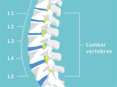Back Pain Disc Problem Archives Spinal Backrack