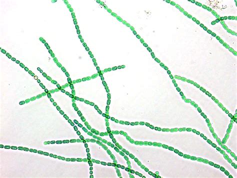 Filamentous Cyanobacterium Nostoc Sp 2 Cyanobacteria Cyano Cbf