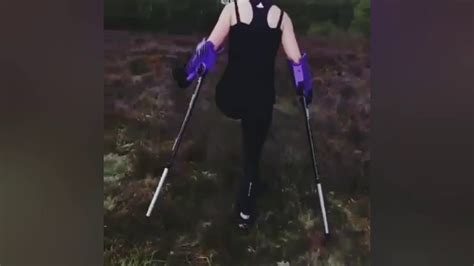Amputee Girl Walking With Crutches Youtube