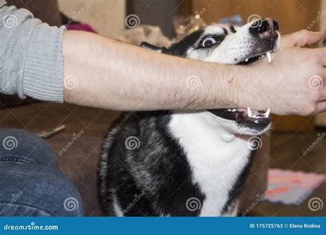 Dream Of Dog Biting Me On Hand Dreamaip