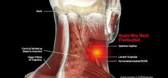 Know your spine, neck pain. physiotherapy Archives | Physio Fitness