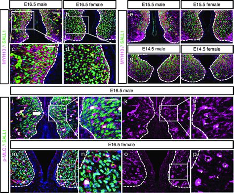 Sexually Dimorphic Expression Of Actomyosin Cytoskeletal Components In Download Scientific