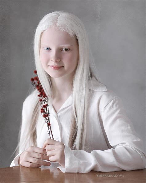 Amina fetița cu albinism care a cucerit lumea cu fizicul ei desprins