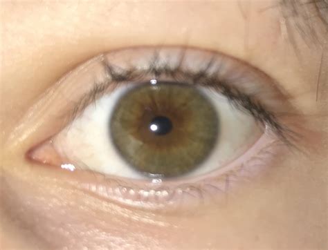 Is This Central Heterochromia A Lot Of People Say My Eyes Are Just