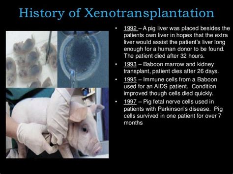 Antibody Engineering And Xenotransplantation