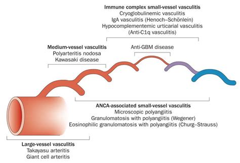 Autoimmune Vasculitis Types