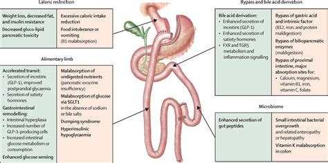 Prevention And Treatment Of Nutritional Complications After Bariatric Surgery The Lancet