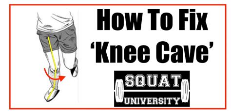 How To Fix ‘knee Cave Squat University