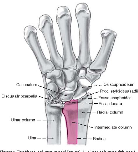 Figure 1 From Dorsal Double Plate Fixation Of The Distal Radius