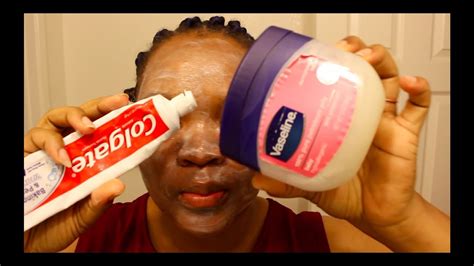 I Applied Colgate Toothpaste And Vaseline On My Face See What Happened After Youtube