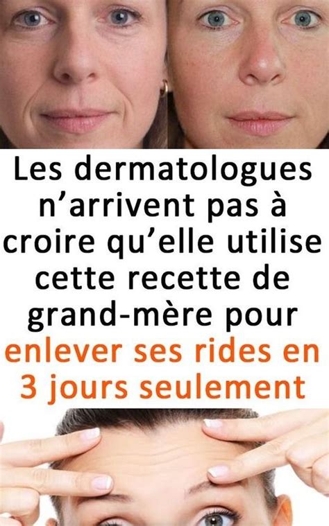 Les Dermatologues Narrivent Pas à Croire Quelle Utilise Cette Recette