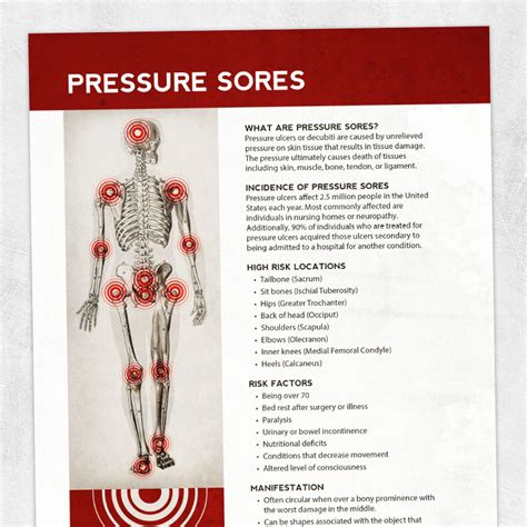 Pressure Sores Adult And Pediatric Printable Resources For Speech And