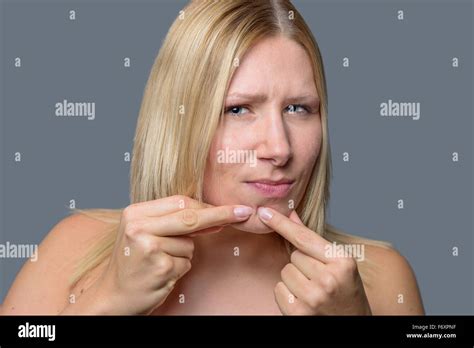 Woman Squeezing A Pimple Spot Zit Or Blackhead On Her Chin With Her Fingers Close Up Of Her