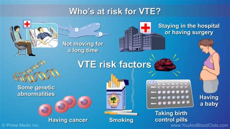 Preventing And Treating Venous Thromboembolism Vte