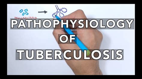 Pathophysiology Of Tuberculosis Youtube