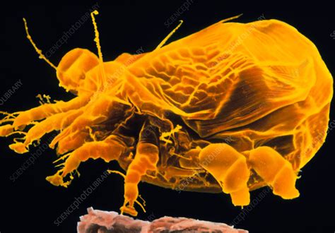 Coloured Sem Of Sarcoptes Sp The Itch Mite Stock Image Z4450234