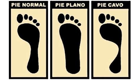 Tipos De Pies ¿cómo Son Los Tuyos Y A Qué Patologías Eres Propenso