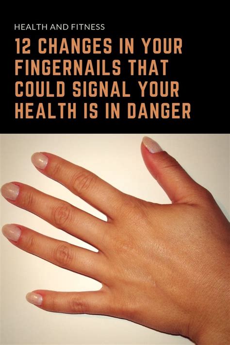 15 Health Warning Signs From Your Fingernails Fingernail Health Signs Fingernail Health Nail