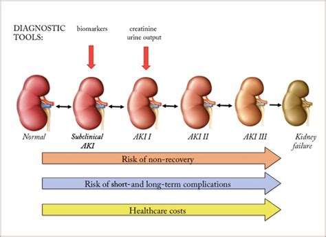 The staging can be based on the. A Renal Failure