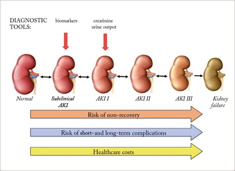 It usually does not produce any symptoms until it progresses to advanced stages. A Renal Failure