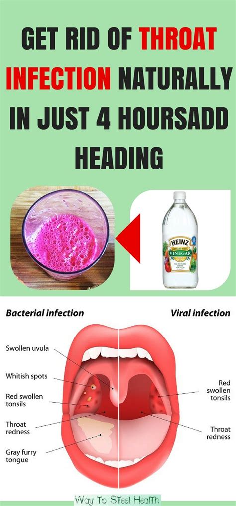 Get Rid Of Throat Infection Naturally In Just 4 Hours Heres What You Need To Do With Images