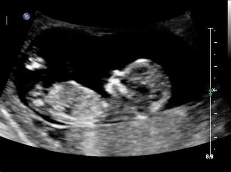 Check spelling or type a new query. 9 Weeks Pregnant: Moody Name Changes - Life with Gremlins