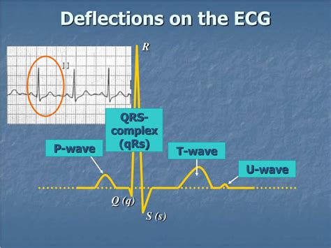 Ppt Introduction To The 12 Lead Ecg Powerpoint Presentation Free